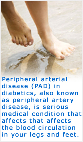 Peripheral Arterial Disease